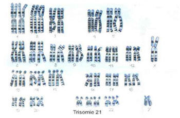 p ersttrimestertest 02