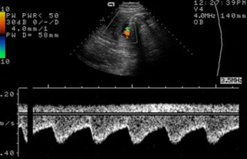 p ultraschall 05