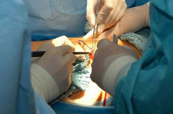 p spina bifida problem ch 1