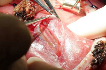 p spina bifida problem ch 6
