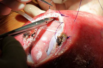 p spina bifida problem ch 9